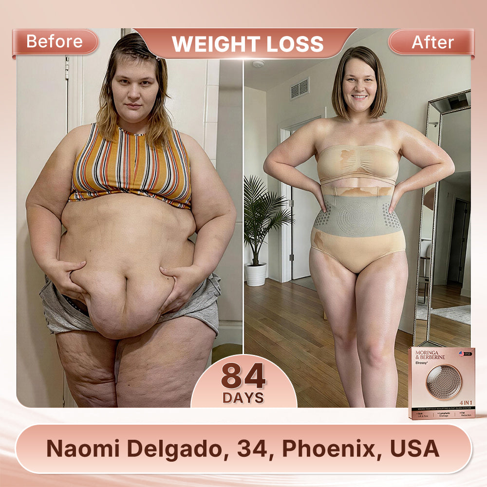 𝐄𝐥𝐫о𝐬𝐨𝐲®🥈𝐌𝐨𝐫𝐢𝐧𝐠𝐚 & 𝐁𝐞𝐫𝐛𝐞𝐫𝐢𝐧𝐞  4-𝐈𝐧-1 𝐌𝐢𝐜𝐫𝐨-𝐏𝐚𝐫𝐭𝐢𝐜𝐥𝐞 𝐒𝐜𝐮𝐥𝐩𝐭𝐢𝐧𝐠 & 𝐅𝐚𝐭-𝐁𝐮𝐫𝐧 𝐒𝐡𝐨𝐫𝐭𝐬🎀