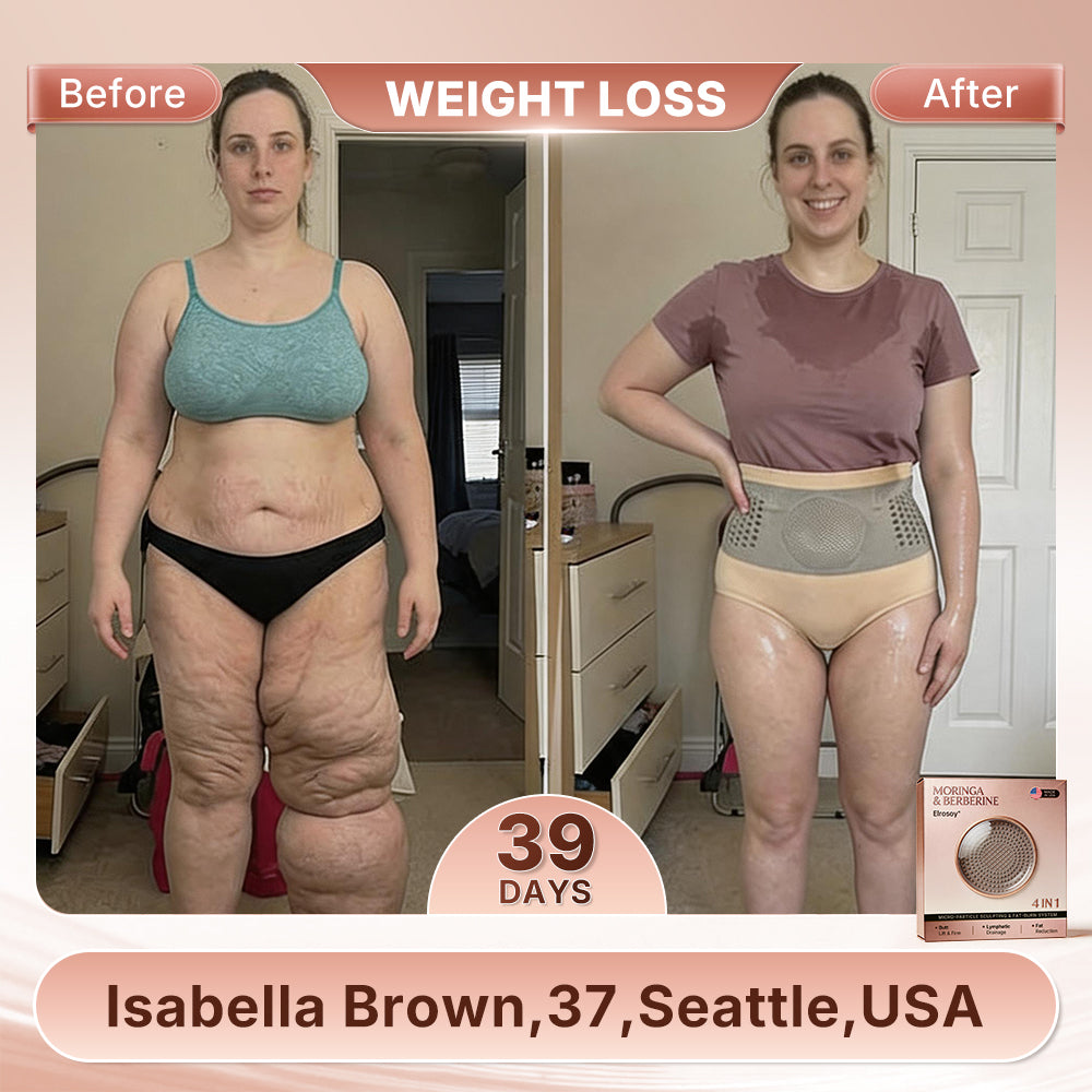 𝐄𝐥𝐫о𝐬𝐨𝐲®🥈𝐌𝐨𝐫𝐢𝐧𝐠𝐚 & 𝐁𝐞𝐫𝐛𝐞𝐫𝐢𝐧𝐞  4-𝐈𝐧-1 𝐌𝐢𝐜𝐫𝐨-𝐏𝐚𝐫𝐭𝐢𝐜𝐥𝐞 𝐒𝐜𝐮𝐥𝐩𝐭𝐢𝐧𝐠 & 𝐅𝐚𝐭-𝐁𝐮𝐫𝐧 𝐒𝐡𝐨𝐫𝐭𝐬🎀